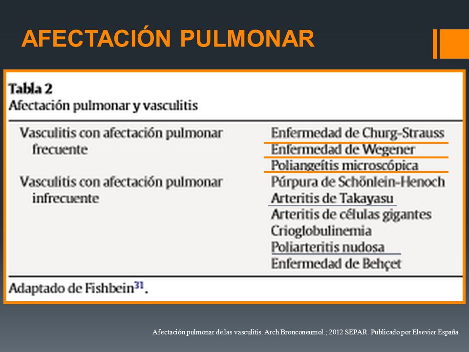 vasculitis pulmonar vasculitis pulmonar